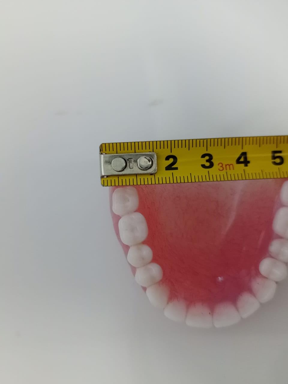 Upper Denture P250