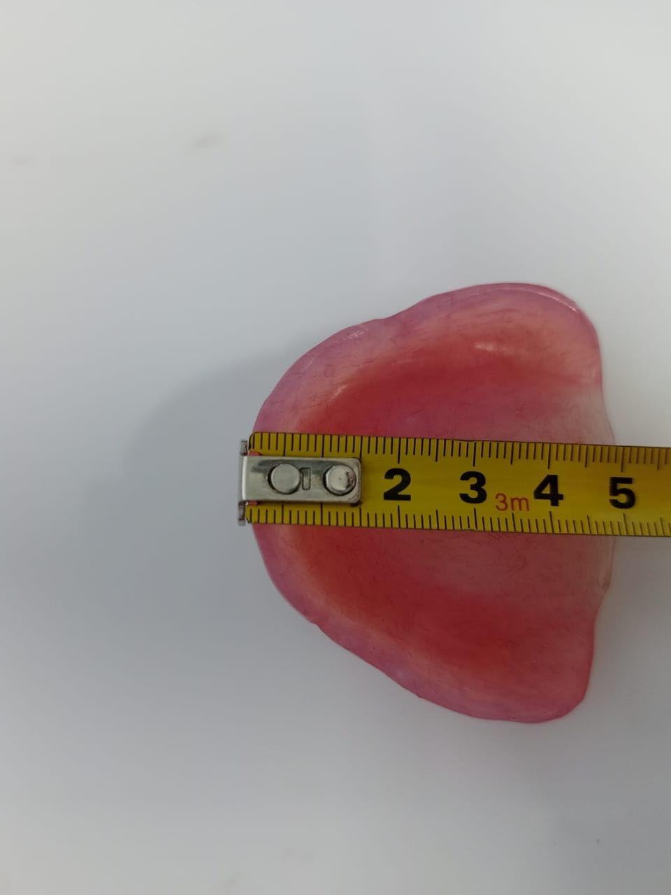 Upper Denture P250